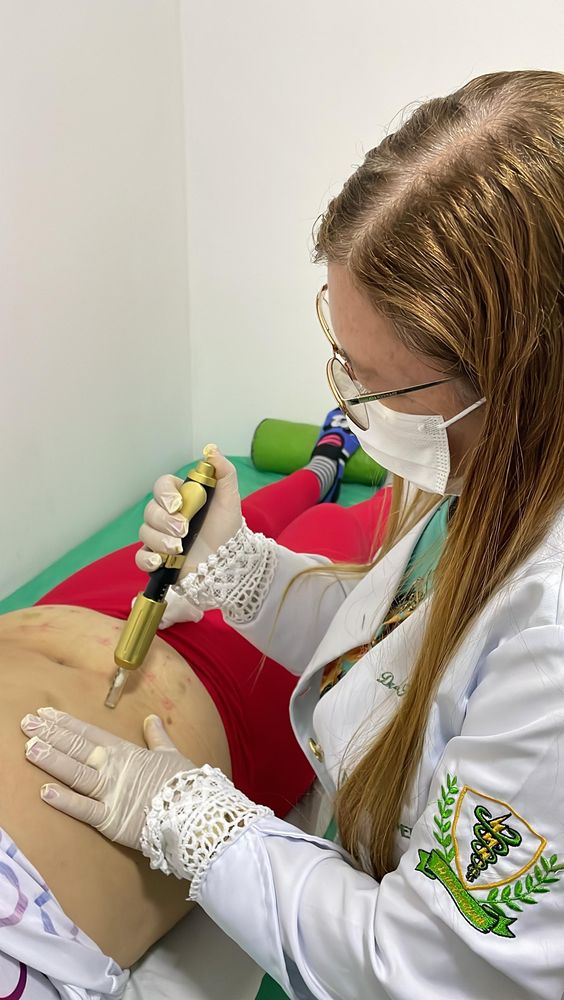 Procedimento de estética corporal no estúdio Lótus, em São Luís