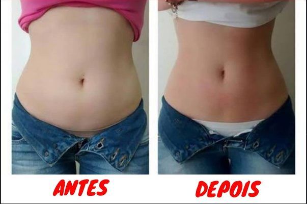 Resultado de estética corporal — antes e depois